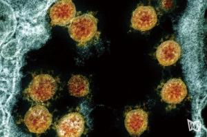 세계 최초 COVID-19 재감염 확인 증명