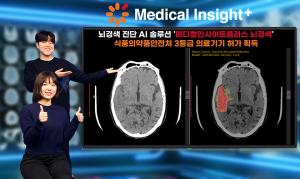 SK C&C, 뇌경색 진단 AI 솔루션 식약처 허가 획득